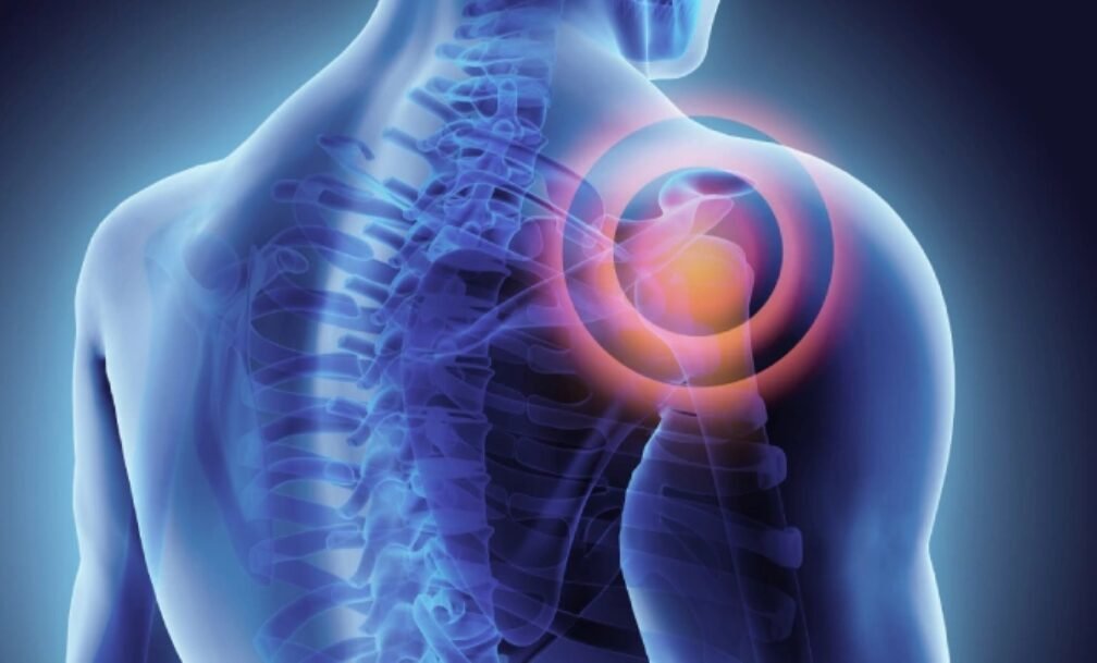 Frozen shoulder treatment in Bangalore