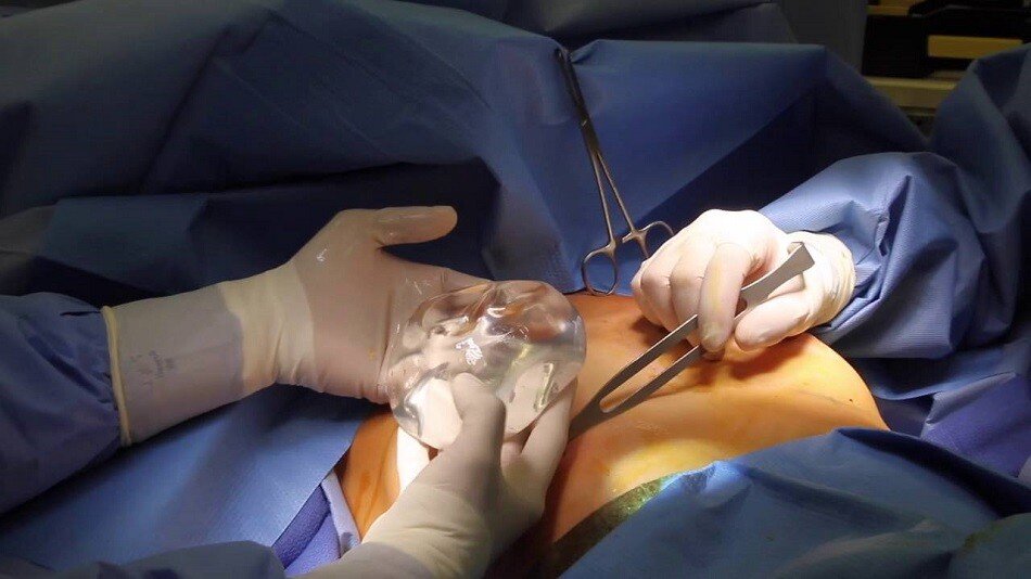 breast augmentation cost in mumbai