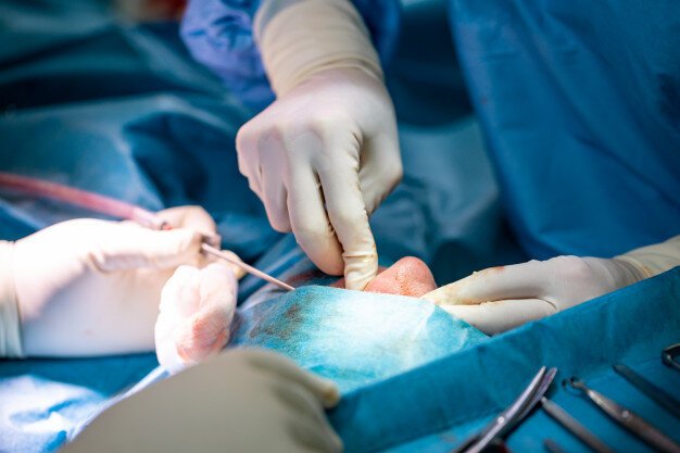 best rhinoplasty surgeon in india